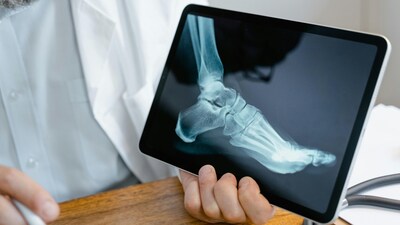 According to the study results, activating GPR133 with AP503 encourages bones to grow while slowing breakdown (Image: Pexels)