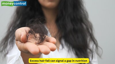 Introducing some foods in your diet like amla can help combat the problem of excess hair fall (Picture: Canva)