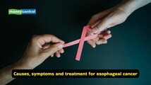 Esophageal Cancer Awareness Month: Why the cancer risk rises manifold from the habits you ignore daily