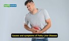 1.8 billion cases of fatty liver disease in the world by 2050, warns Lancet report