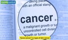 What is 'saree cancer'? A rare condition caused by the way women tie their petticoat