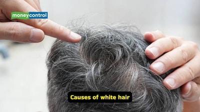 Myths and truth behind grey hair, stress plucking, and false cures