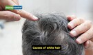 Myths and truth behind grey hair, stress plucking, and false cures
