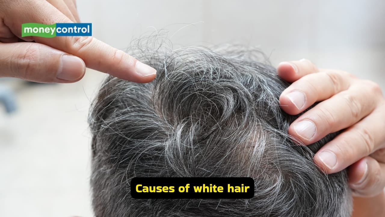 https://images.moneycontrol.com/static-mcnews/2026/04/20260417050218_Causes-of-white-hair.jpg