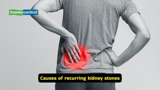 Recurring kidney stones can be prevented by drinking more water, but staying hydrated is the biggest challenge
