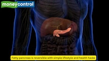 Fatty pancreas: A silent but progressive disease; know its symptoms, causes, treatment plan and more