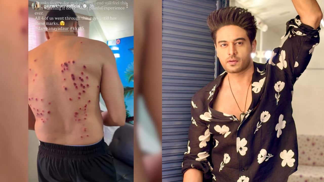 Khatron Ke Khiladi Contestants Injured by Rubber Bullets in Pain Auction Stunt