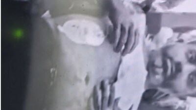 Watch | First visuals of Captain Smit emerge after cockpit attack, chest and abdomen heavily bandaged